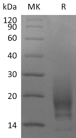 Human CD63 +SDS-PAGE.jpg